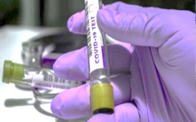 О разработке экспресс-тестов на коронавирус в Великобритании